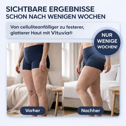 Vituvia BodyLift™ – Für straffere Haut